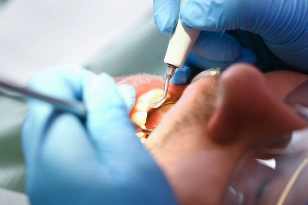 Best Emergency Wisdom Teeth Removal in Sunland Park, NM